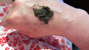 neoderma bio peeling kruiden