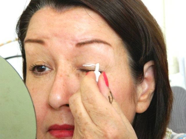 ooglidcorrectie met lijm