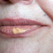 lip-primer