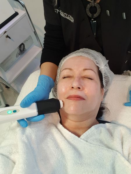 Mijn behandeling met de OxyGeneo & TriPollar- Anti-Aging, Huidverstrakking en minder Pigmentatie! 7 Mijn behandeling met de OxyGeneo & TriPollar- Anti-Aging, Huidverstrakking en minder Pigmentatie! 6 oxygeneo Mijn behandeling met de OxyGeneo & TriPollar- Anti-Aging, Huidverstrakking en minder Pigmentatie!