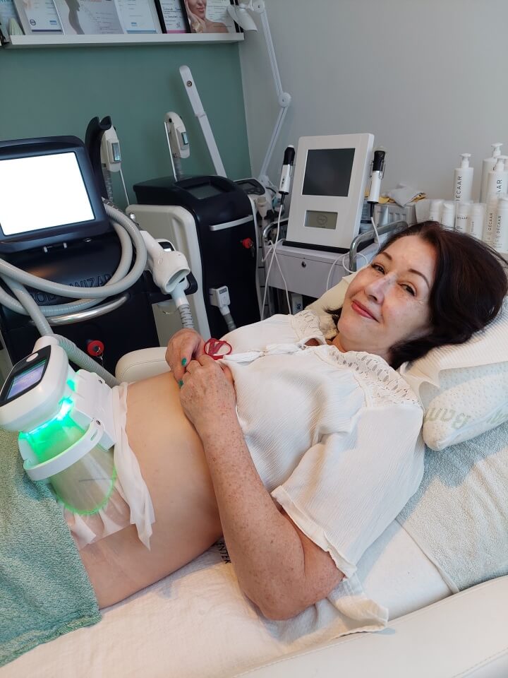 Mijn ervaring met Cryolipolyse bij Beauty Clinic Tiel 7 Mijn ervaring met Cryolipolyse bij Beauty Clinic Tiel