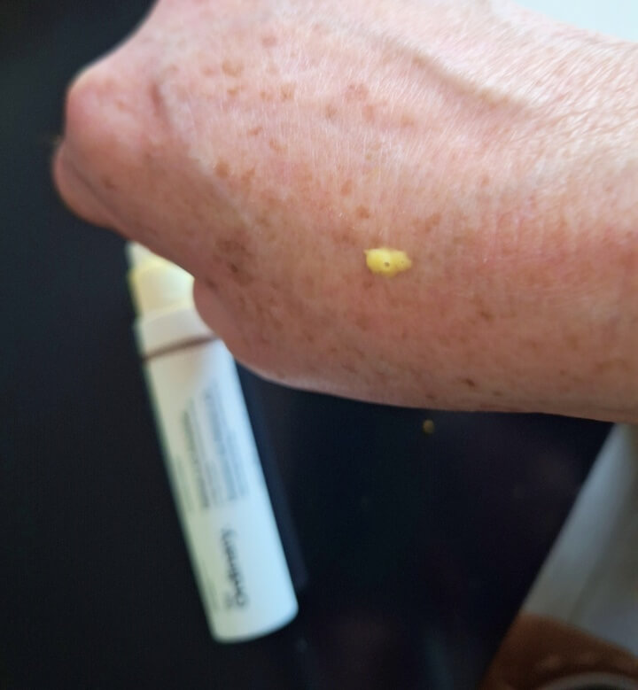 The Ordinary Retinal 0,2% Emulsion Serum- Review 3 retinal The Ordinary Retinal 0,2% Emulsion Serum- Review