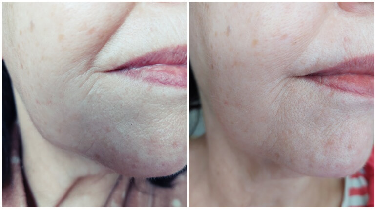  Nieuw! Loveli Collagen serum - Review 8 loveli collagen serum  Nieuw! Loveli Collagen serum - Review