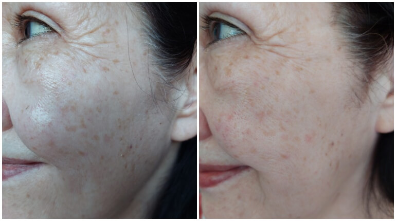  Nieuw! Loveli Collagen serum - Review 6 loveli collagen serum  Nieuw! Loveli Collagen serum - Review